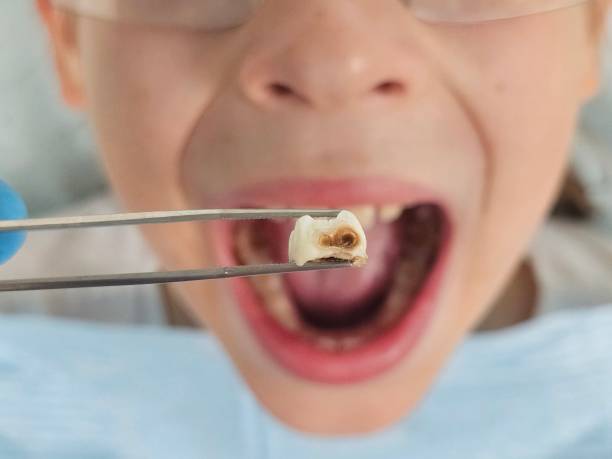 Professional Emergency Dental Service in NE